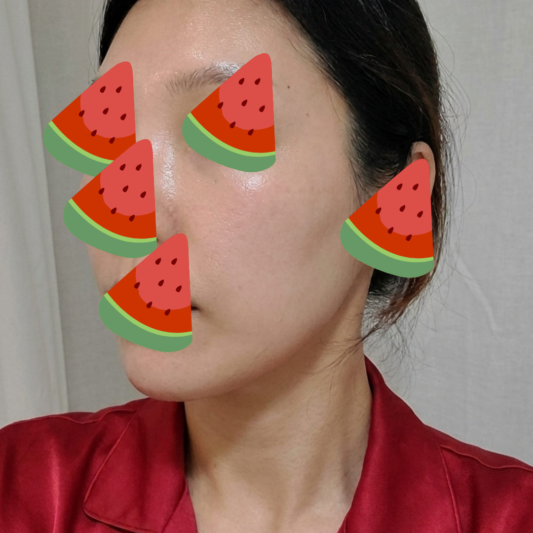 수술후기이미지