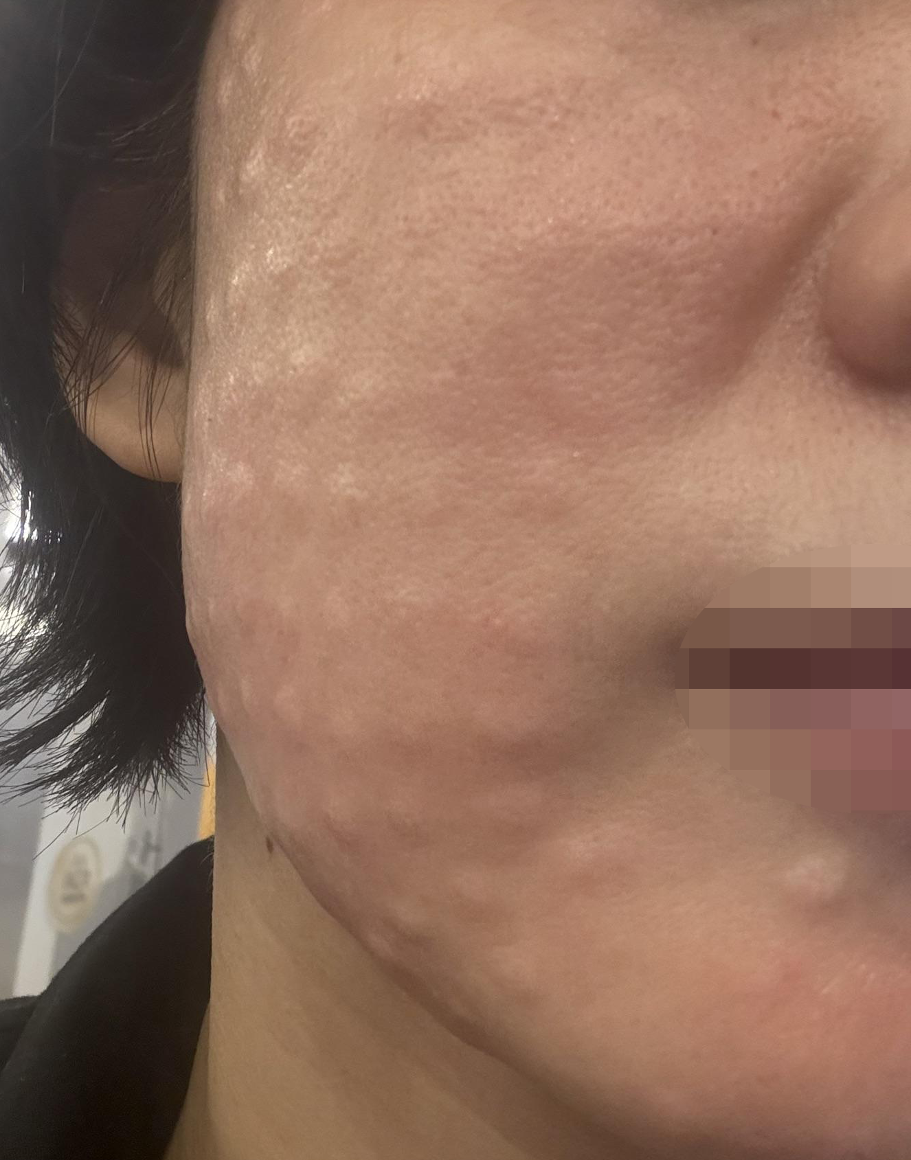 수술후기이미지