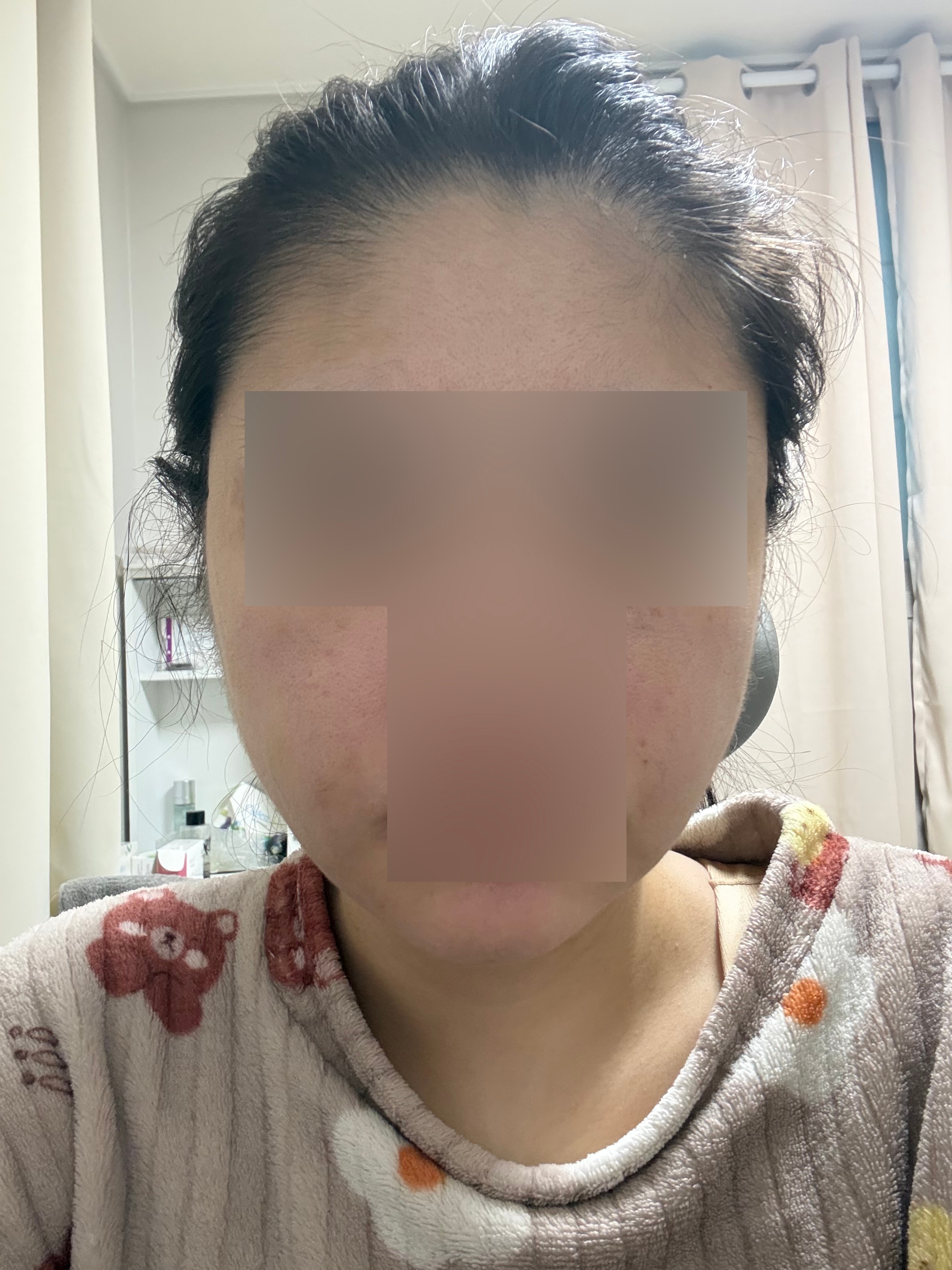 수술후기이미지