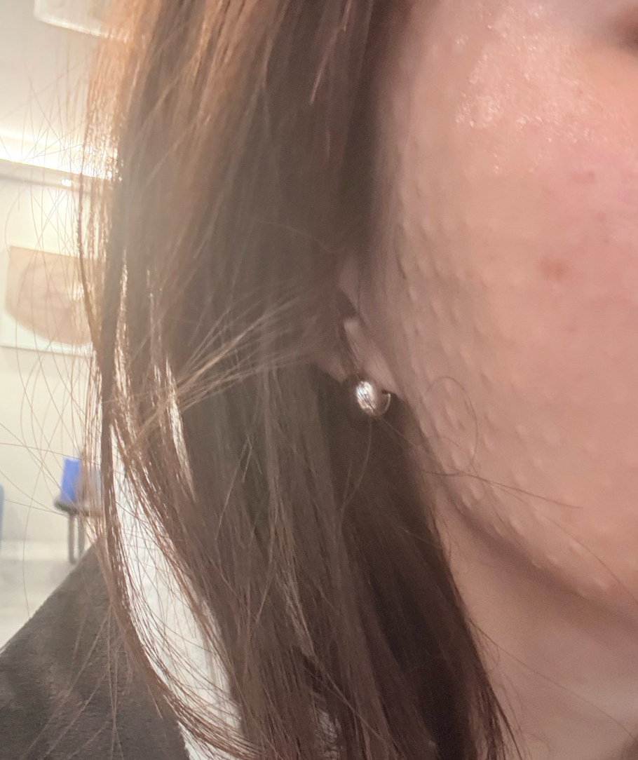 수술후기이미지