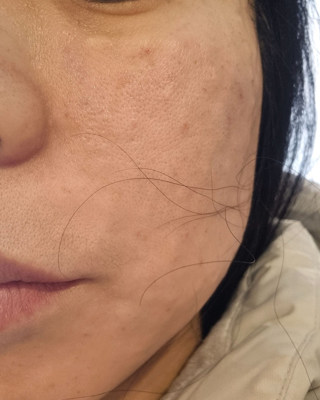 수술후기이미지