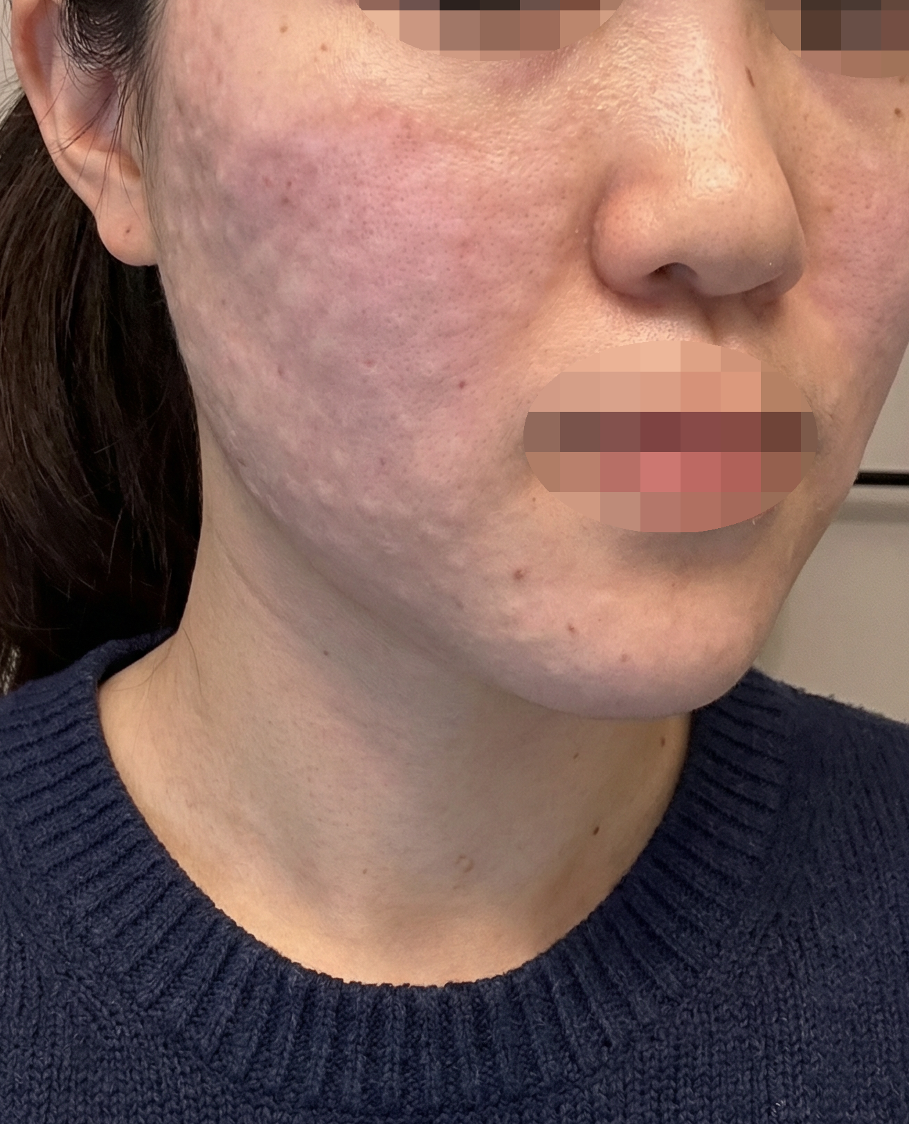 수술후기이미지