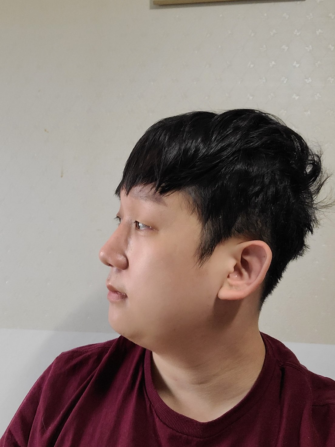 수술후기이미지