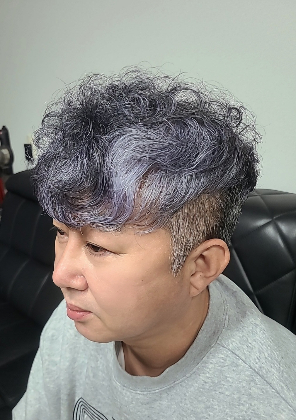 수술후기이미지