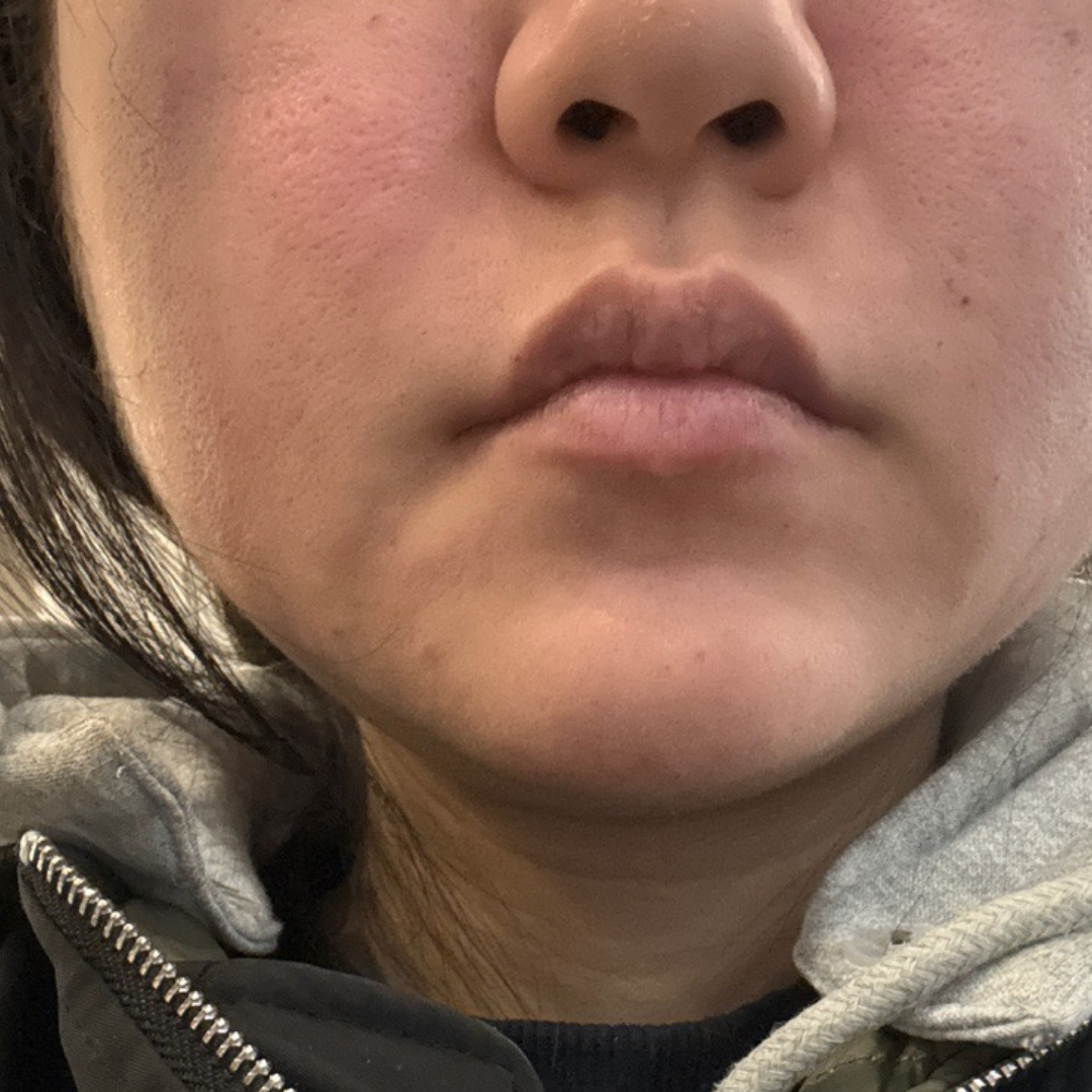 수술후기이미지