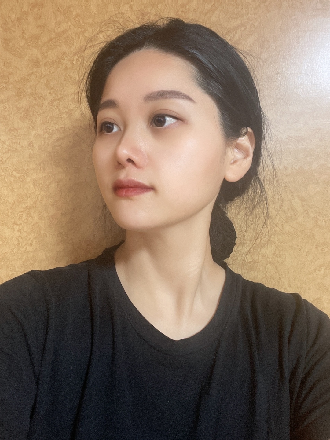 수술후기이미지