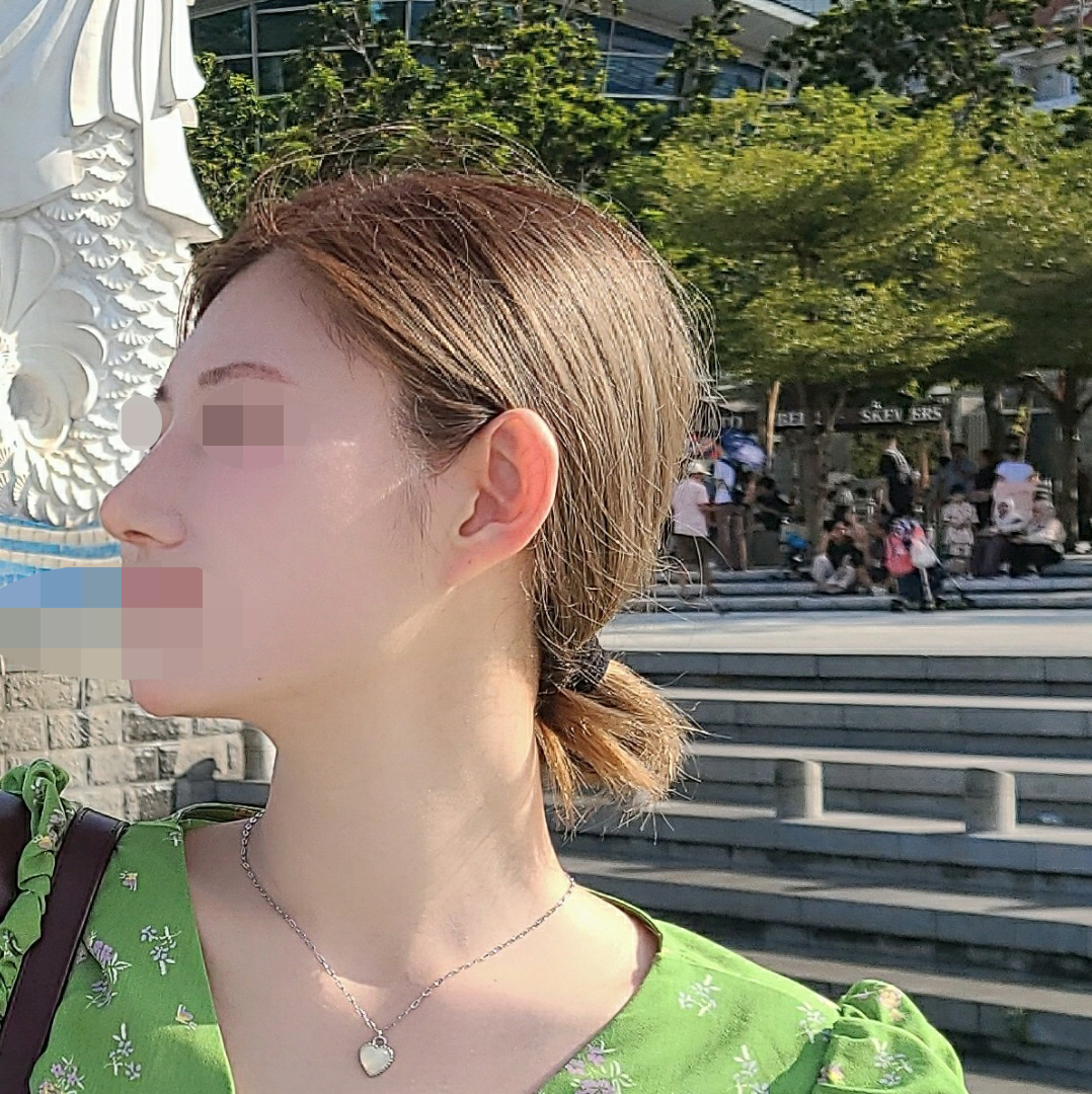 수술후기이미지