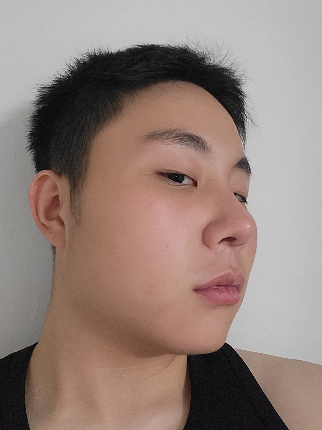 수술후기이미지