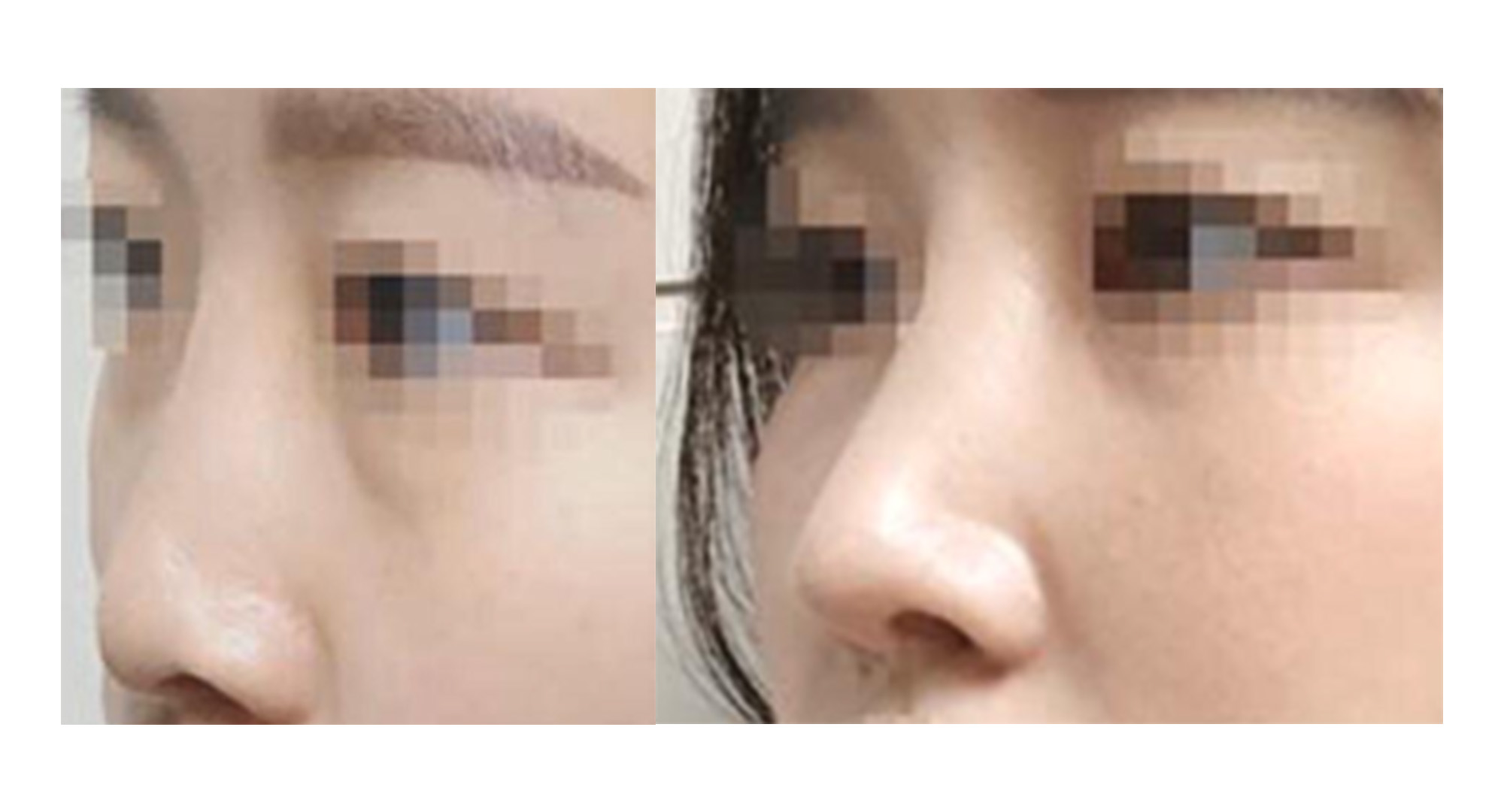 수술후기이미지