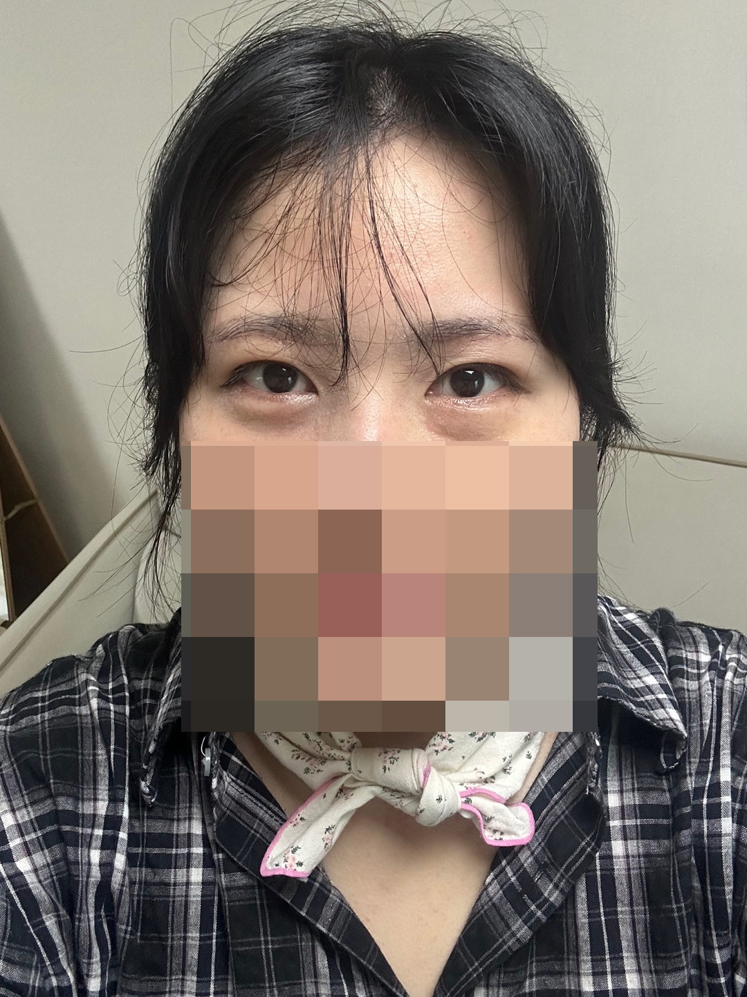 수술후기이미지