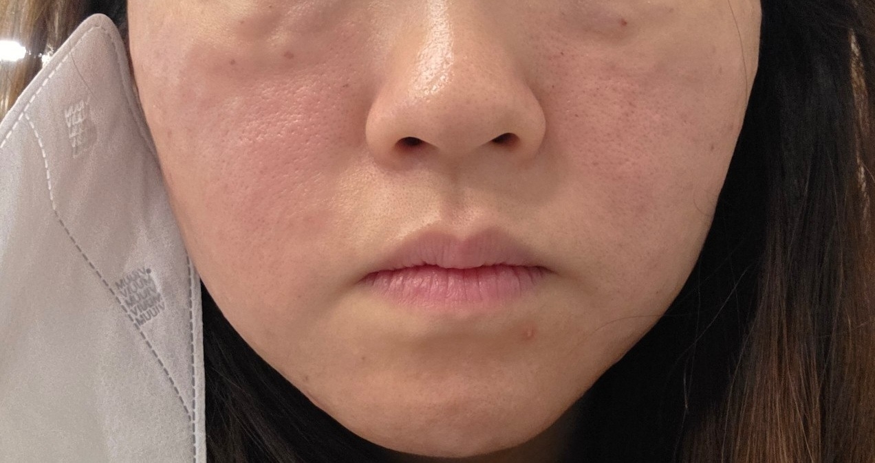 수술후기이미지