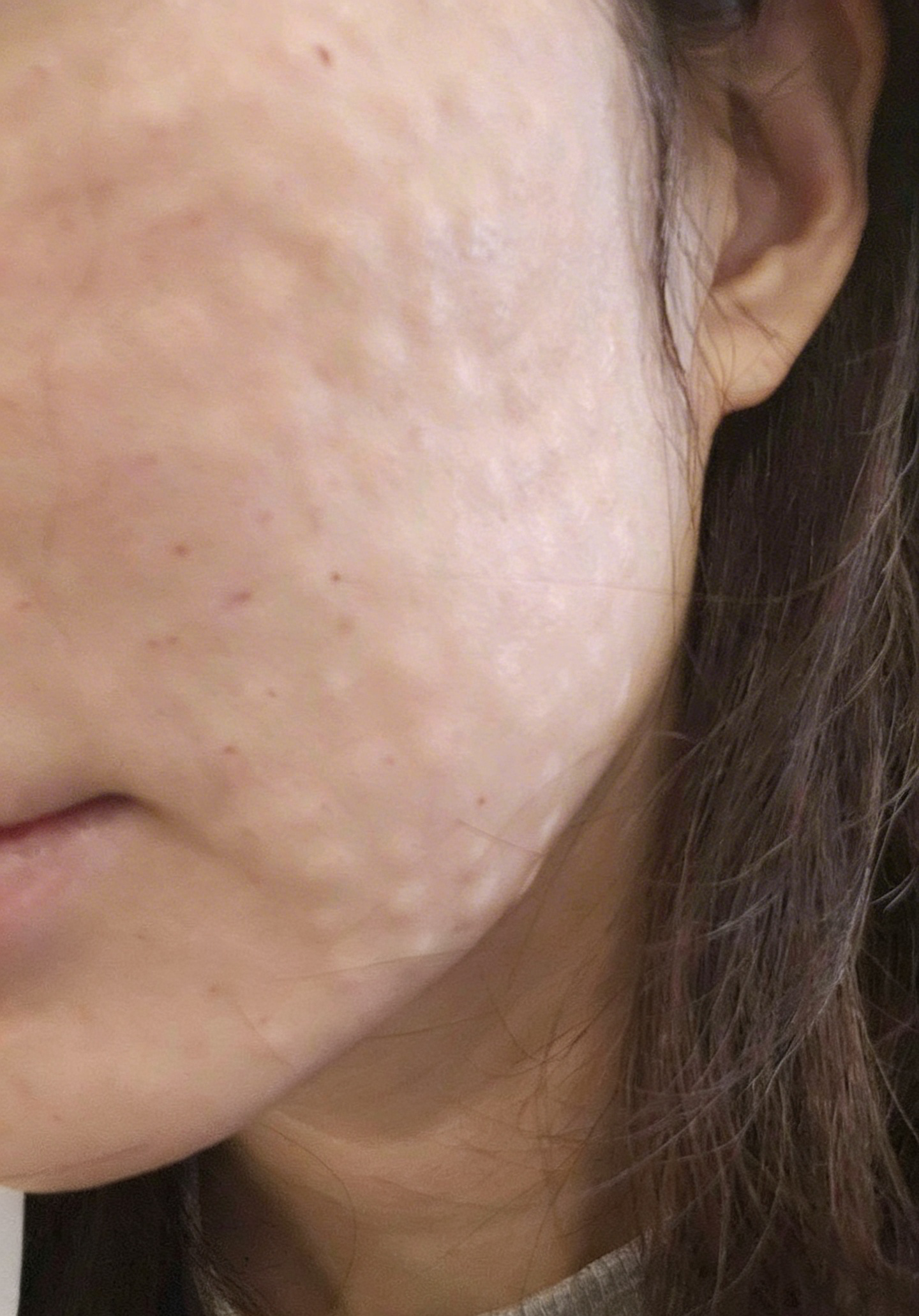 수술후기이미지