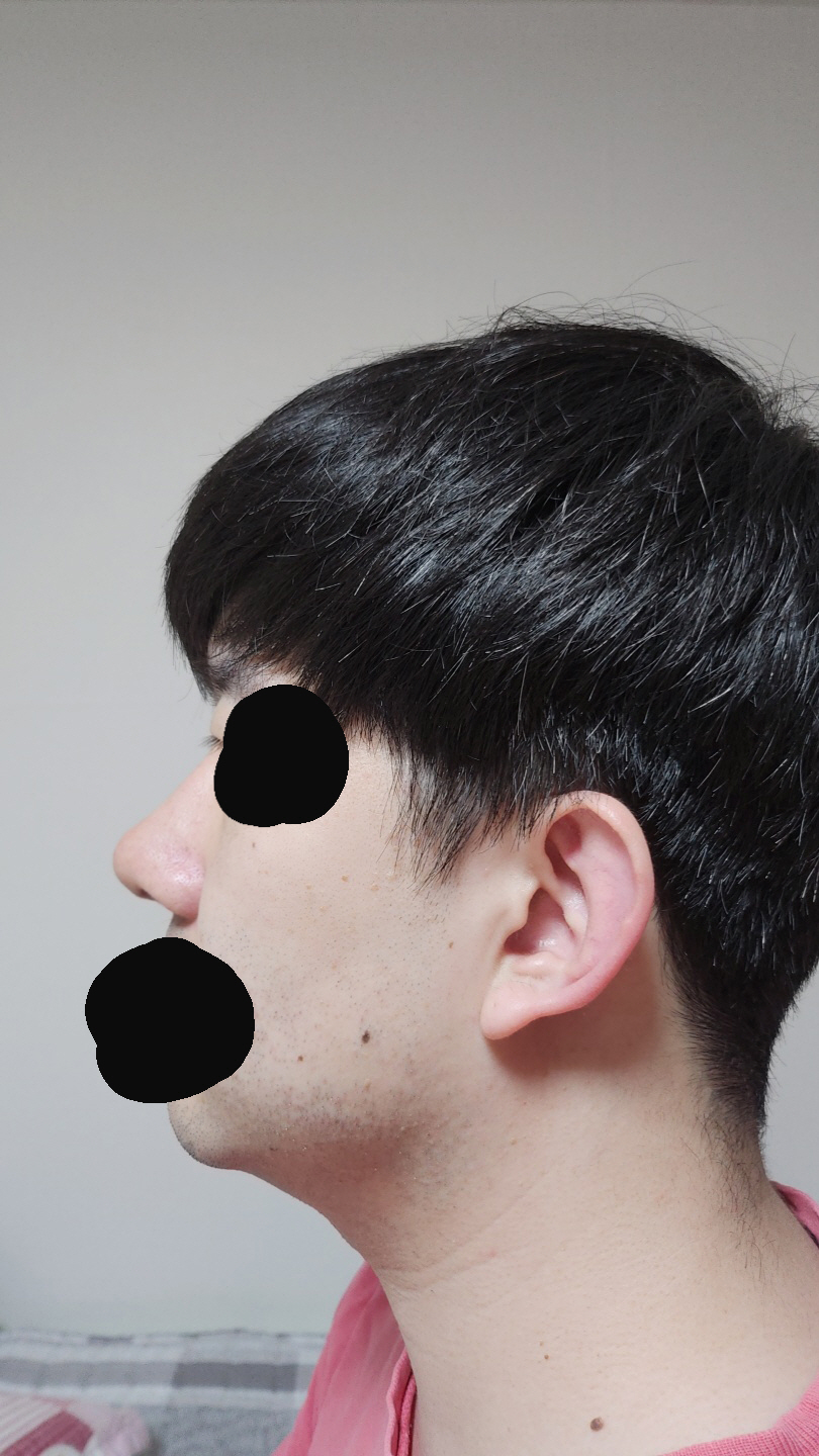 수술후기이미지