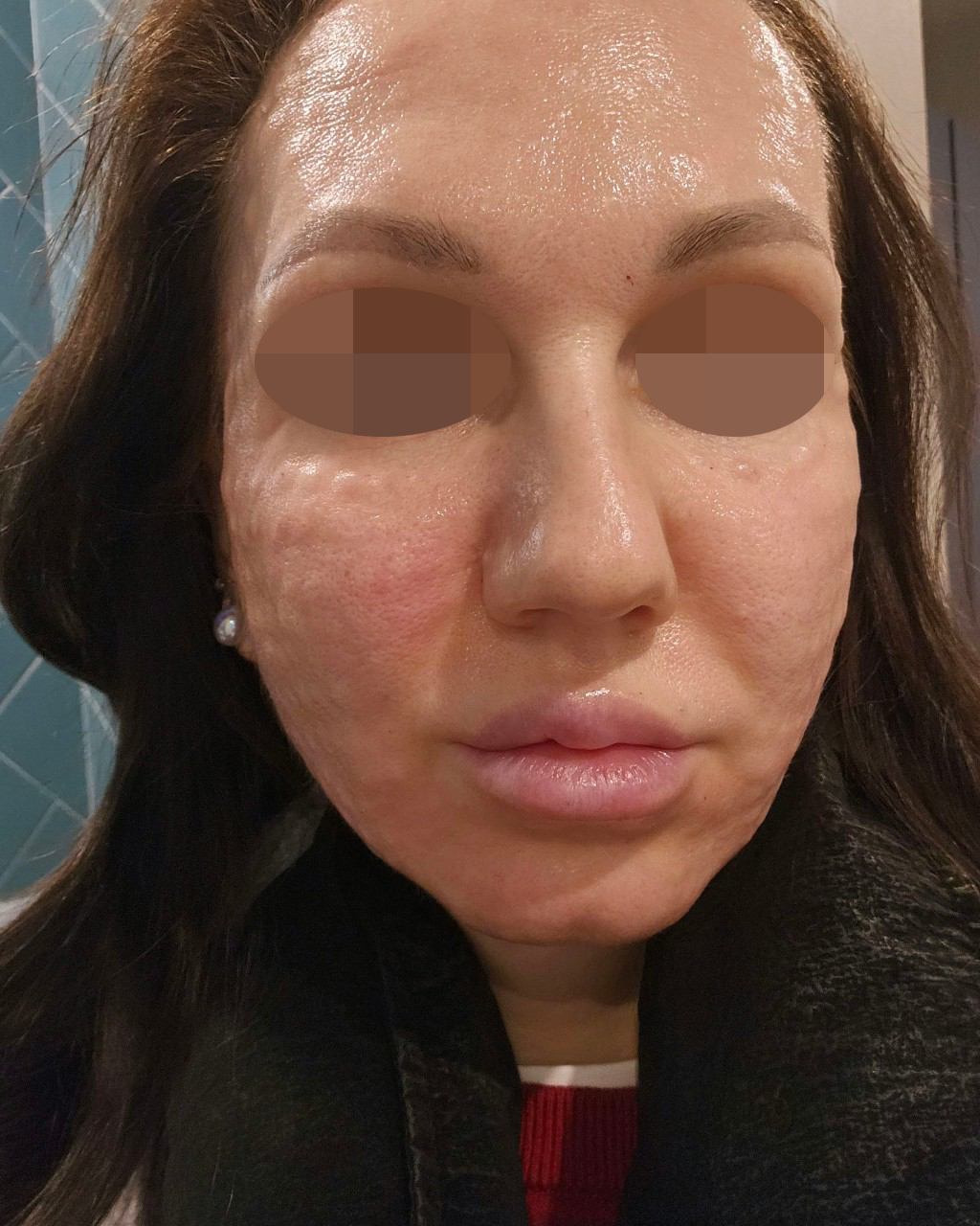 수술후기이미지