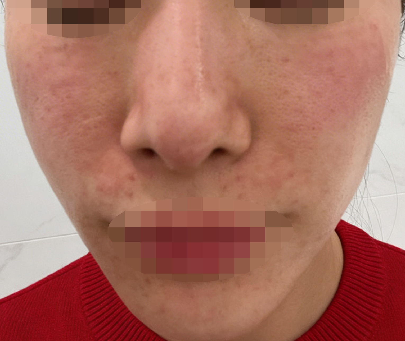 수술후기이미지