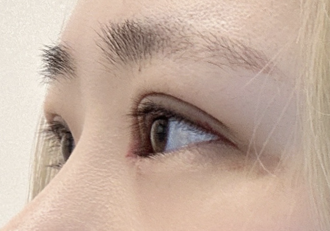 수술후기이미지