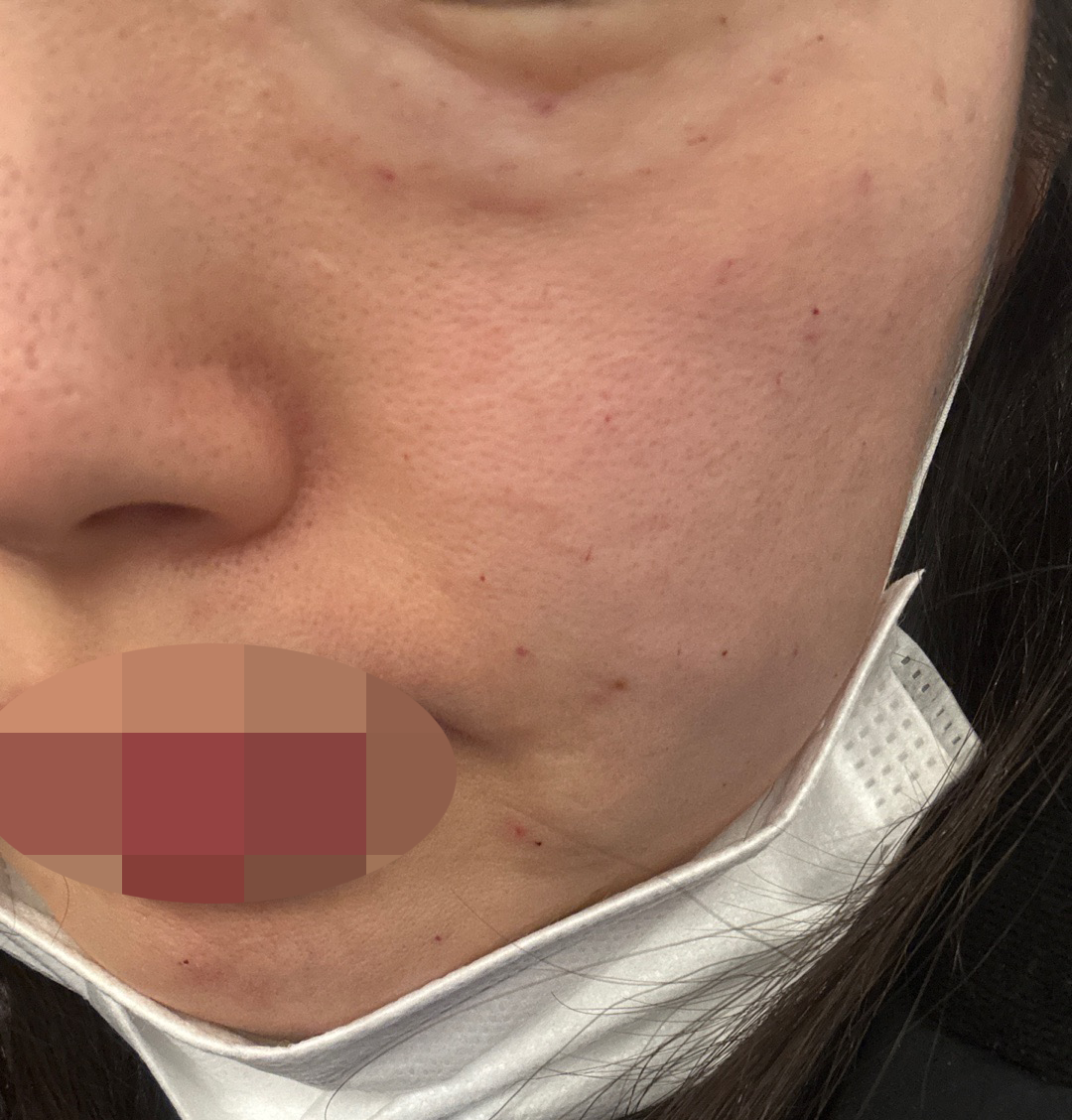 수술후기이미지