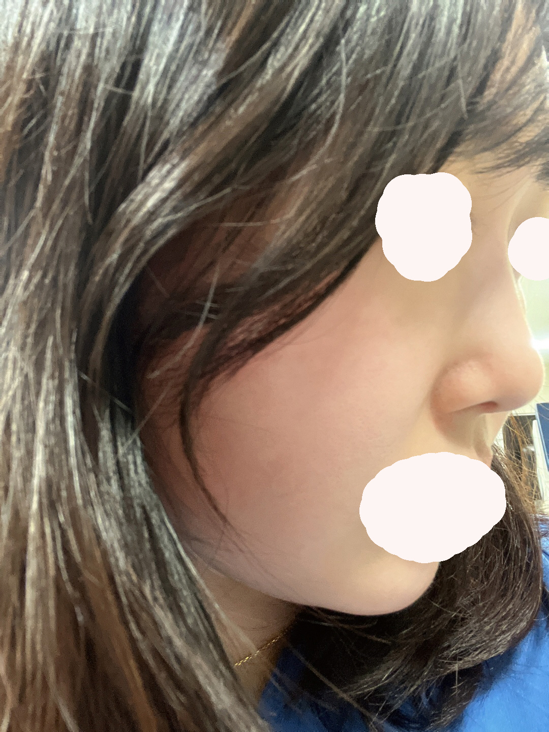 수술후기이미지