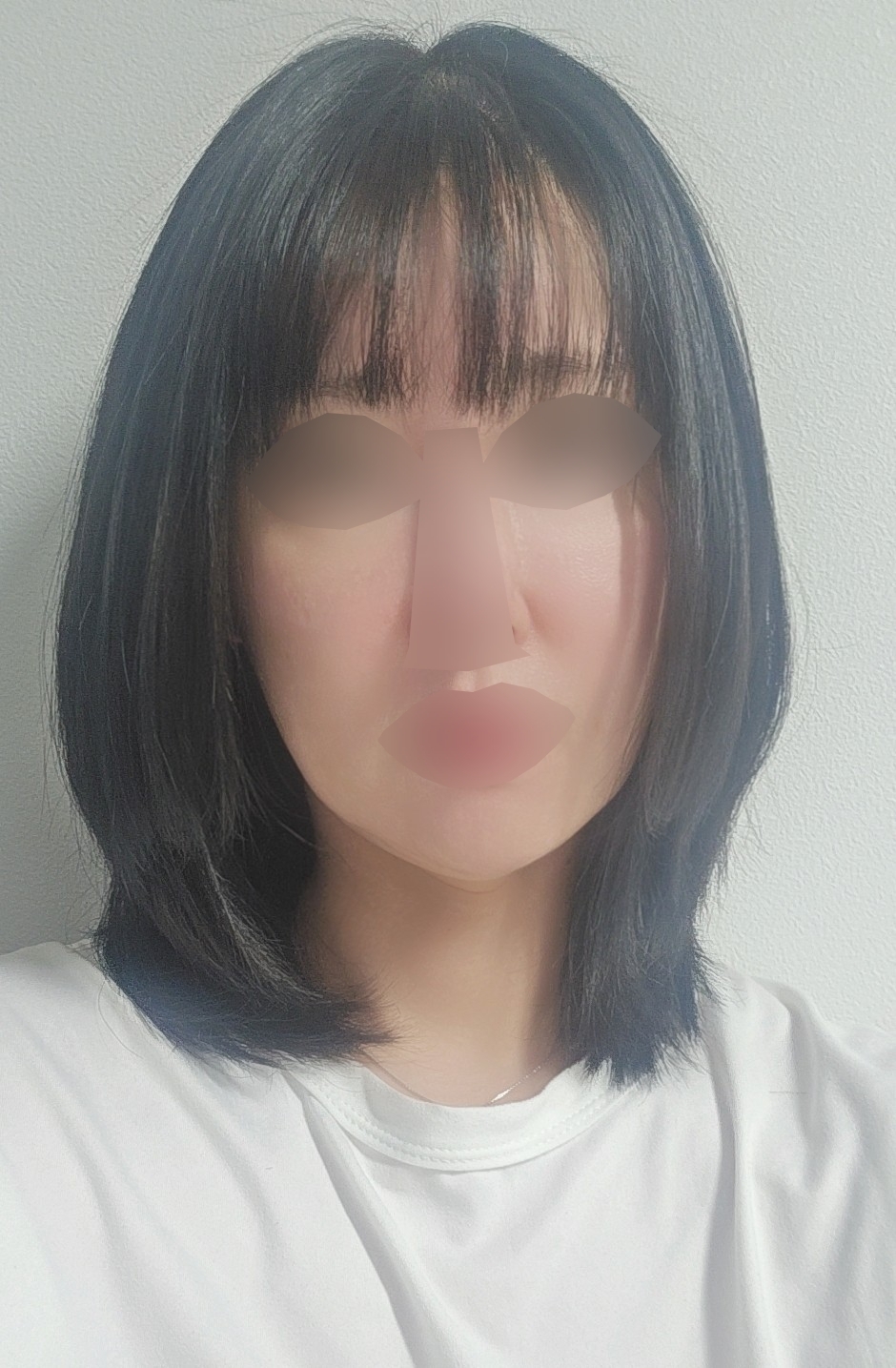 수술후기이미지