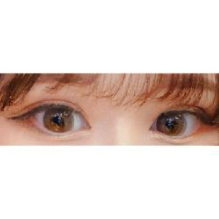 수술후기이미지