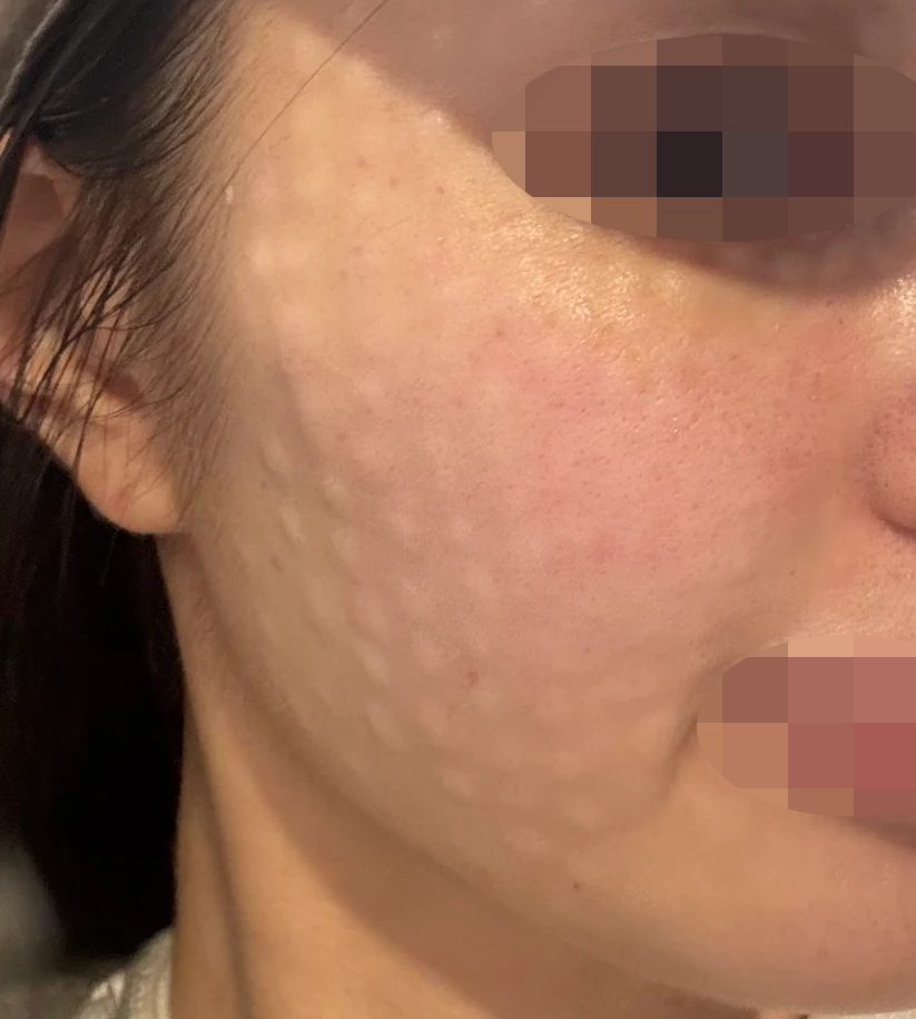 수술후기이미지