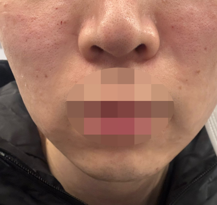 수술후기이미지