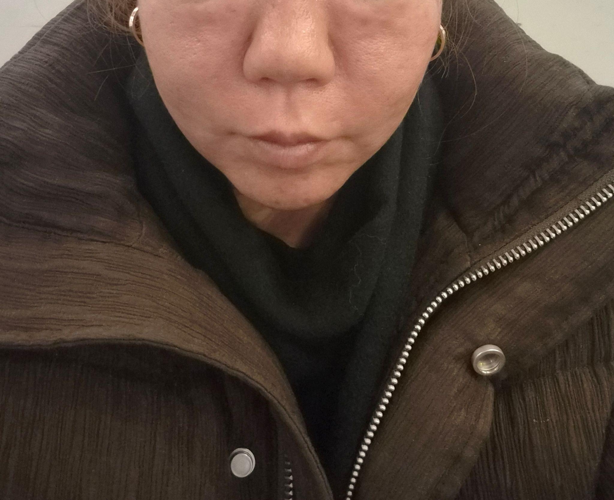 수술후기이미지