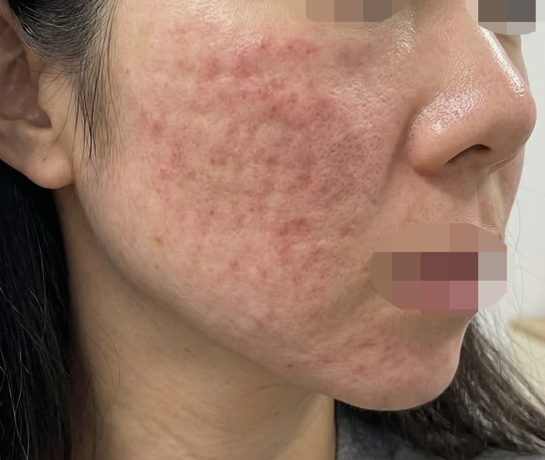 수술후기이미지