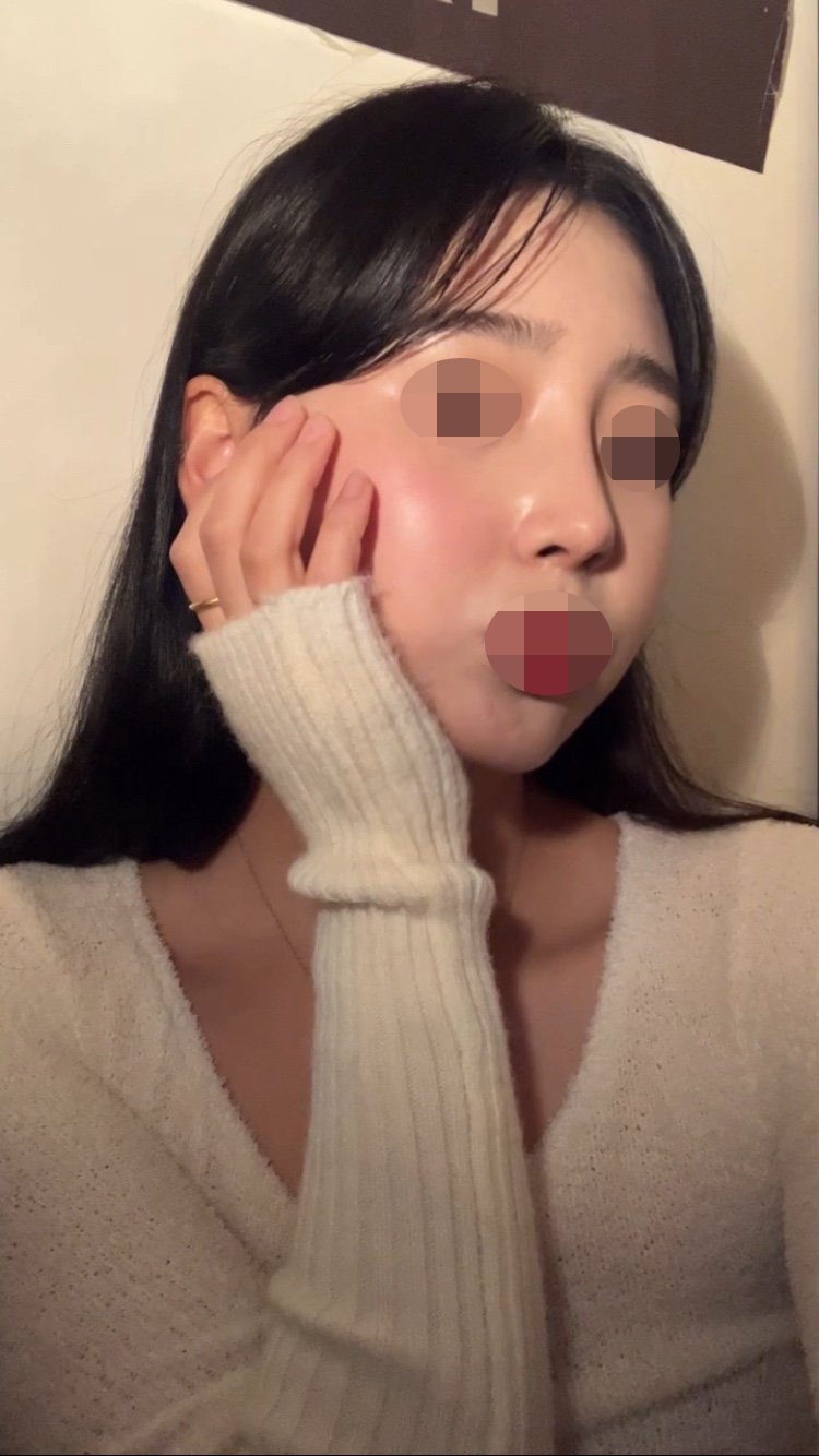 수술후기이미지