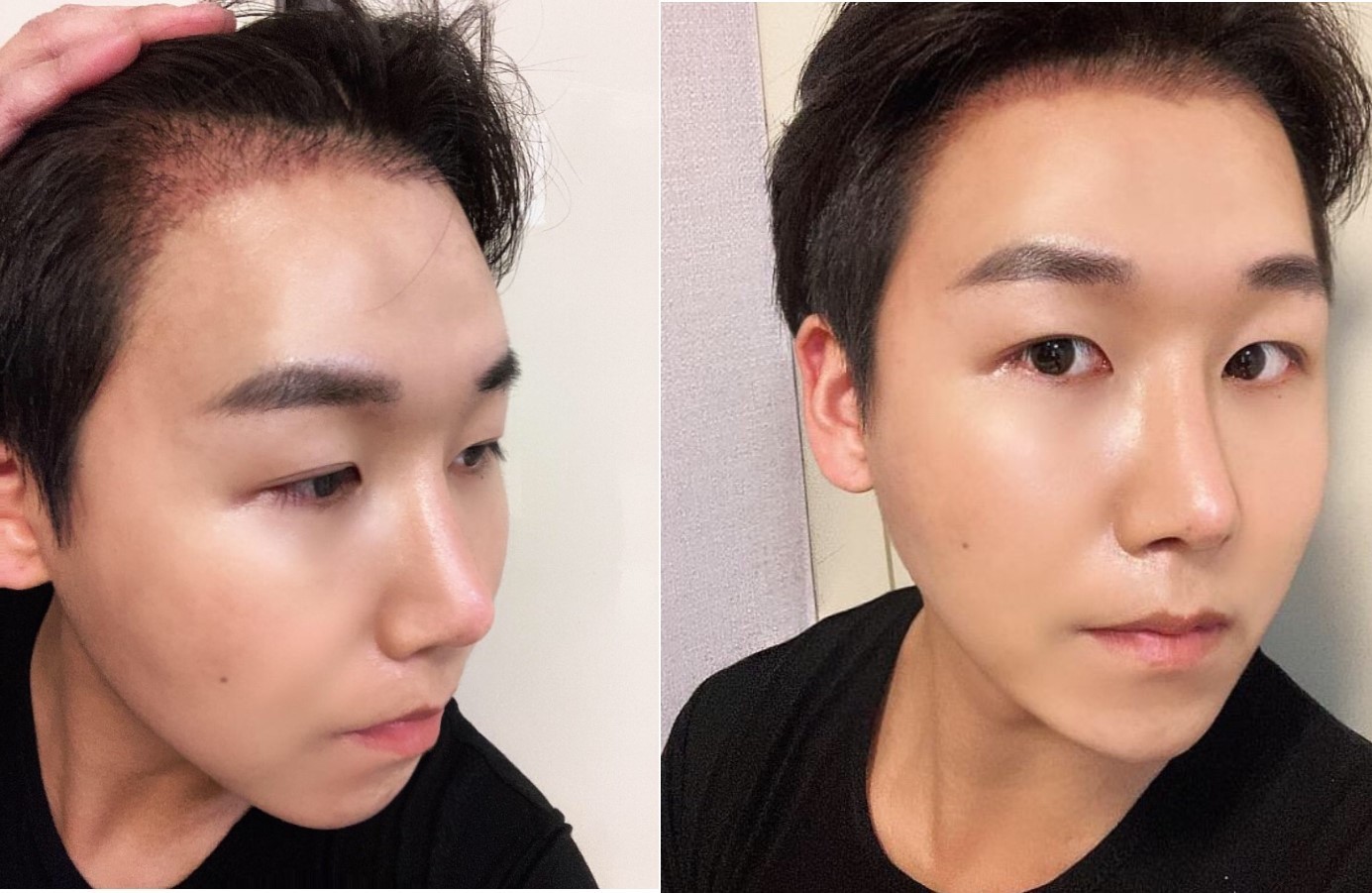 수술후기이미지