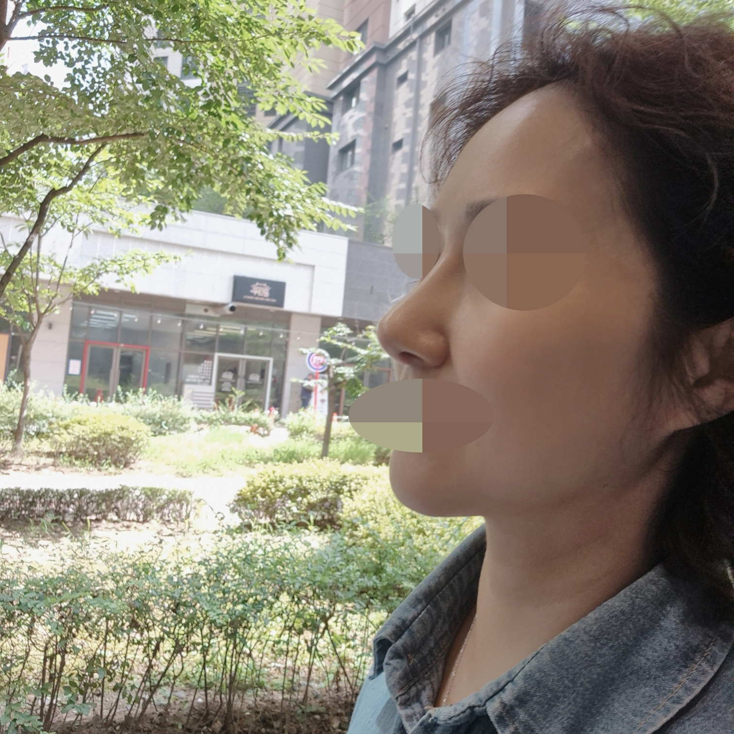 수술후기이미지