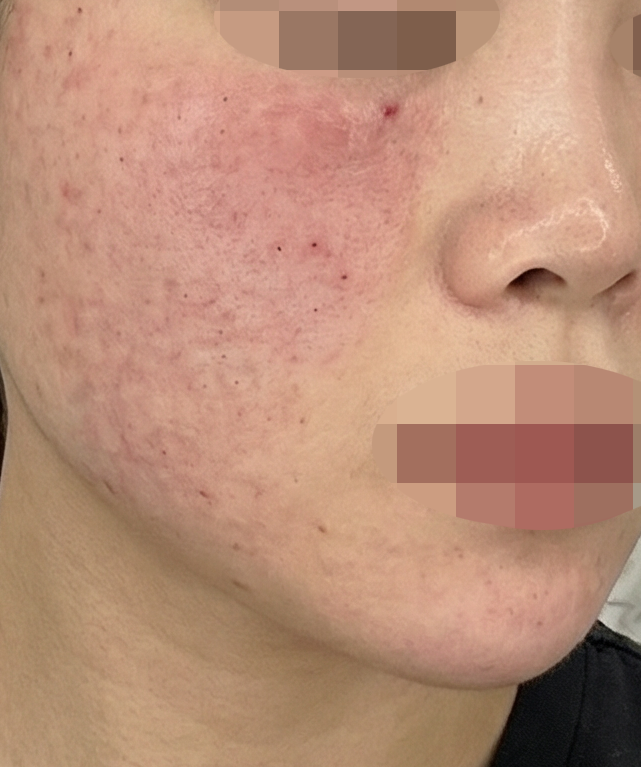 수술후기이미지