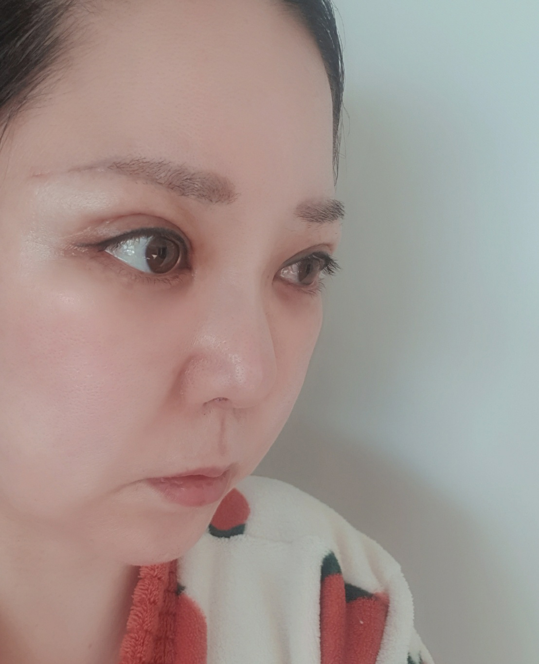 수술후기이미지