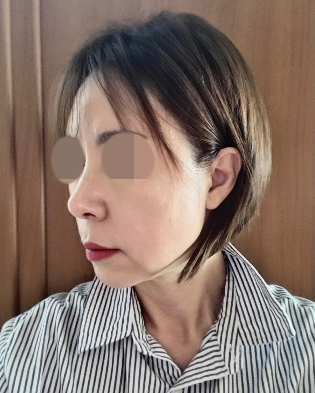 수술후기이미지