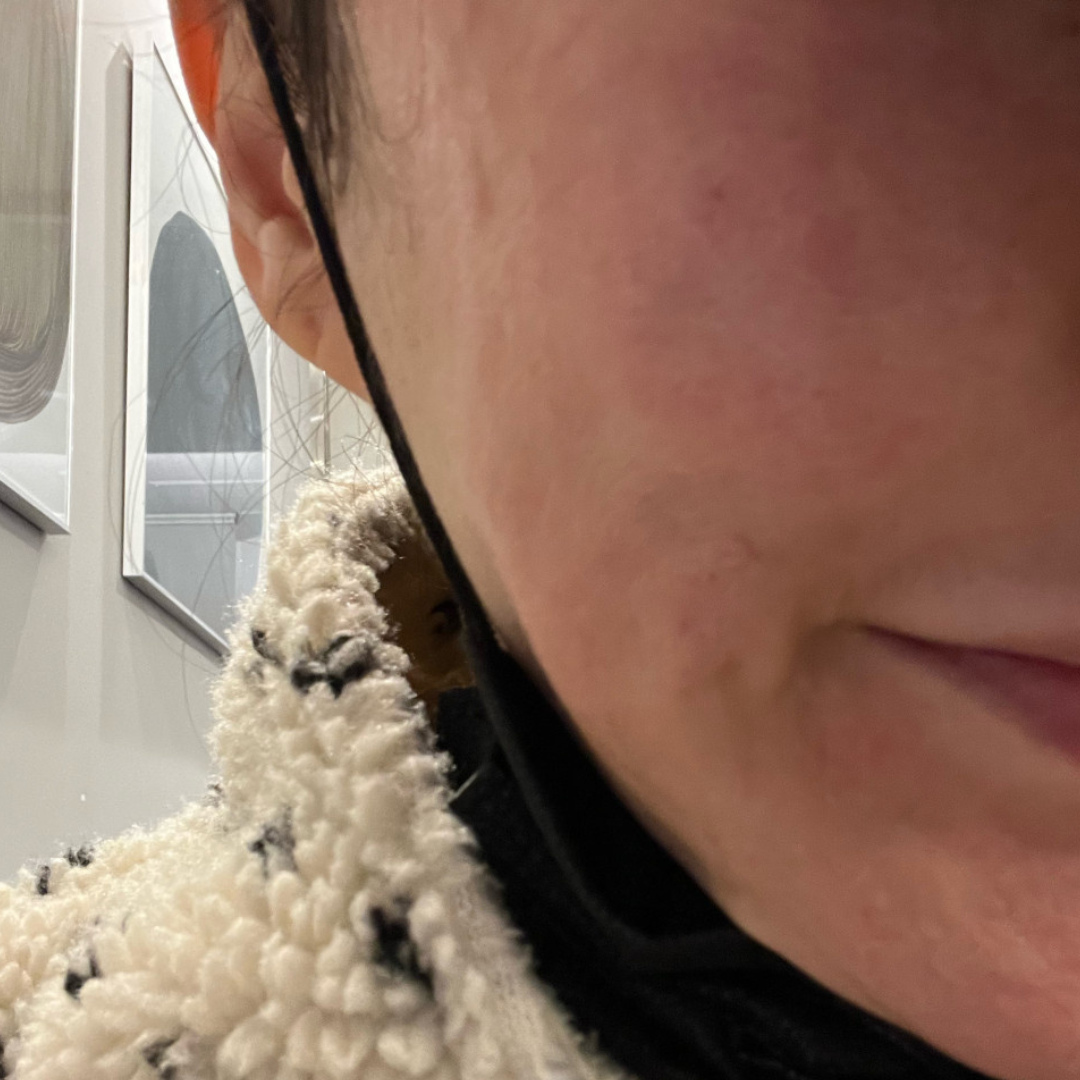 수술후기이미지