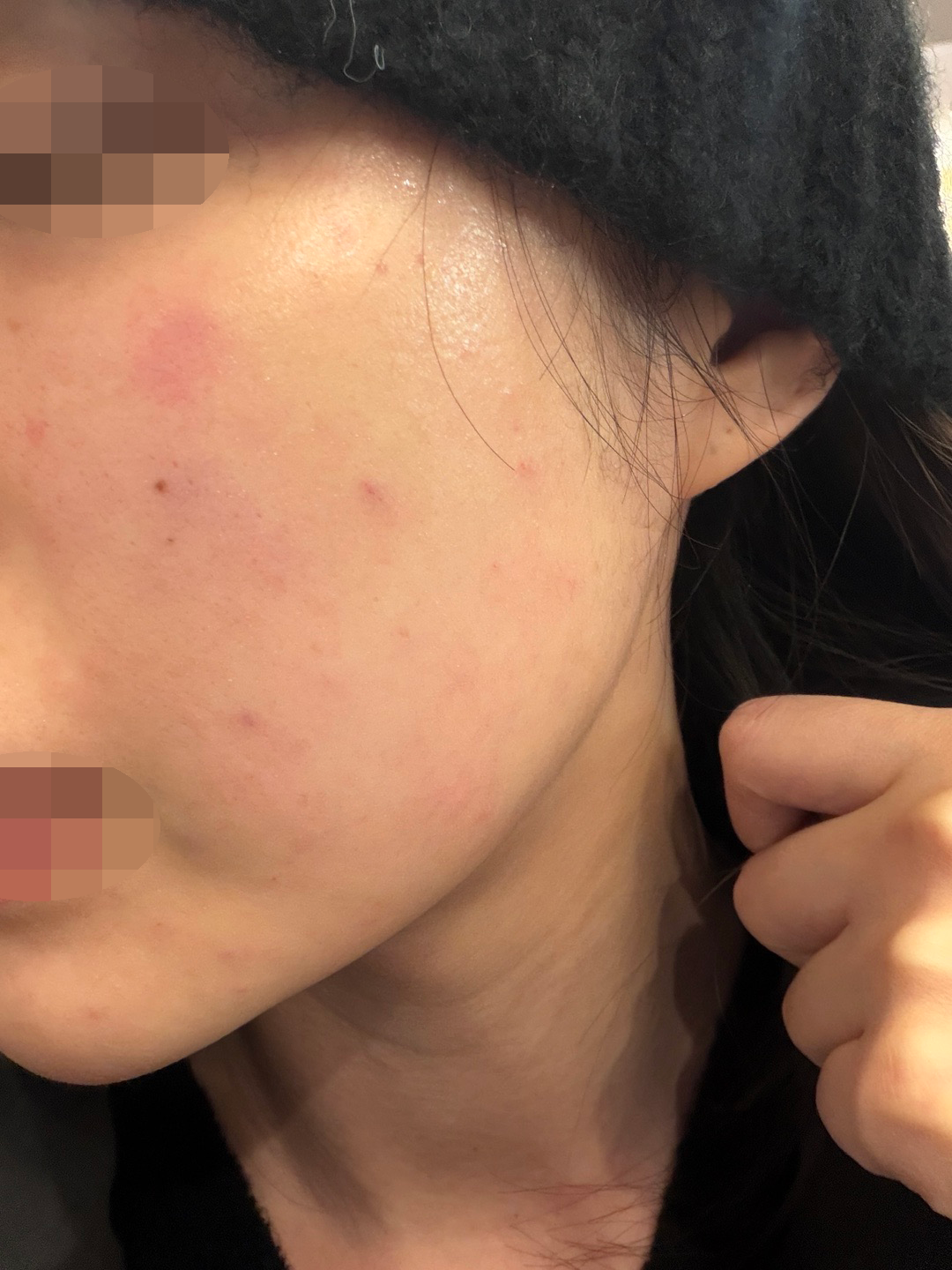 수술후기이미지