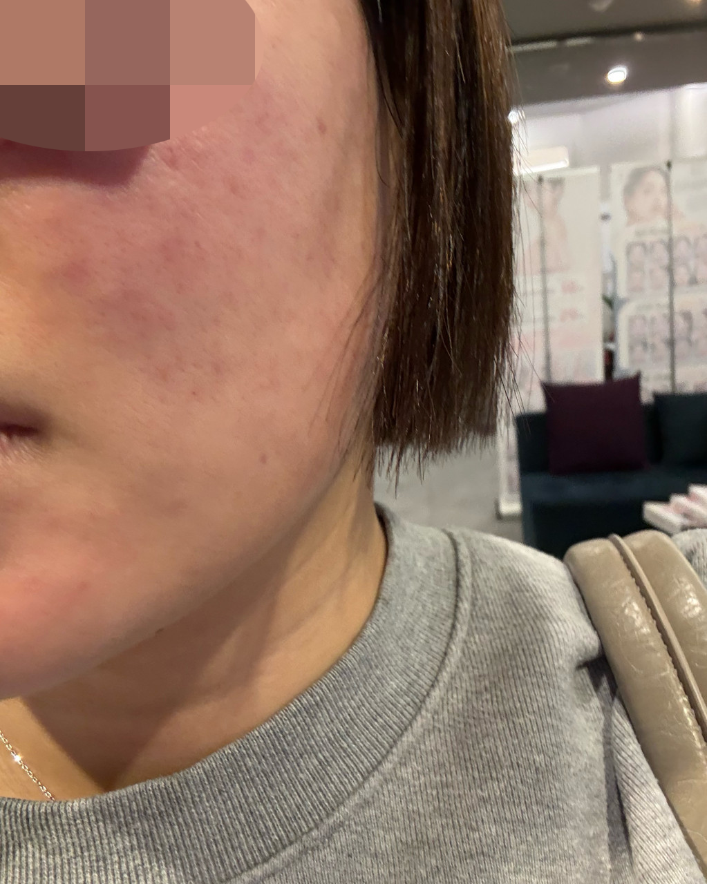 수술후기이미지