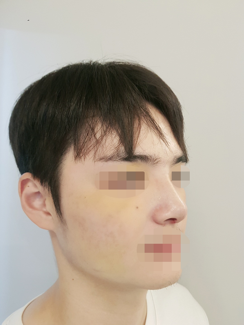 수술후기이미지