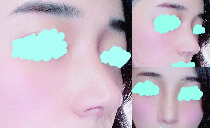 수술후기이미지