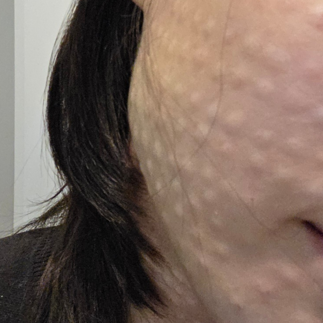 수술후기이미지