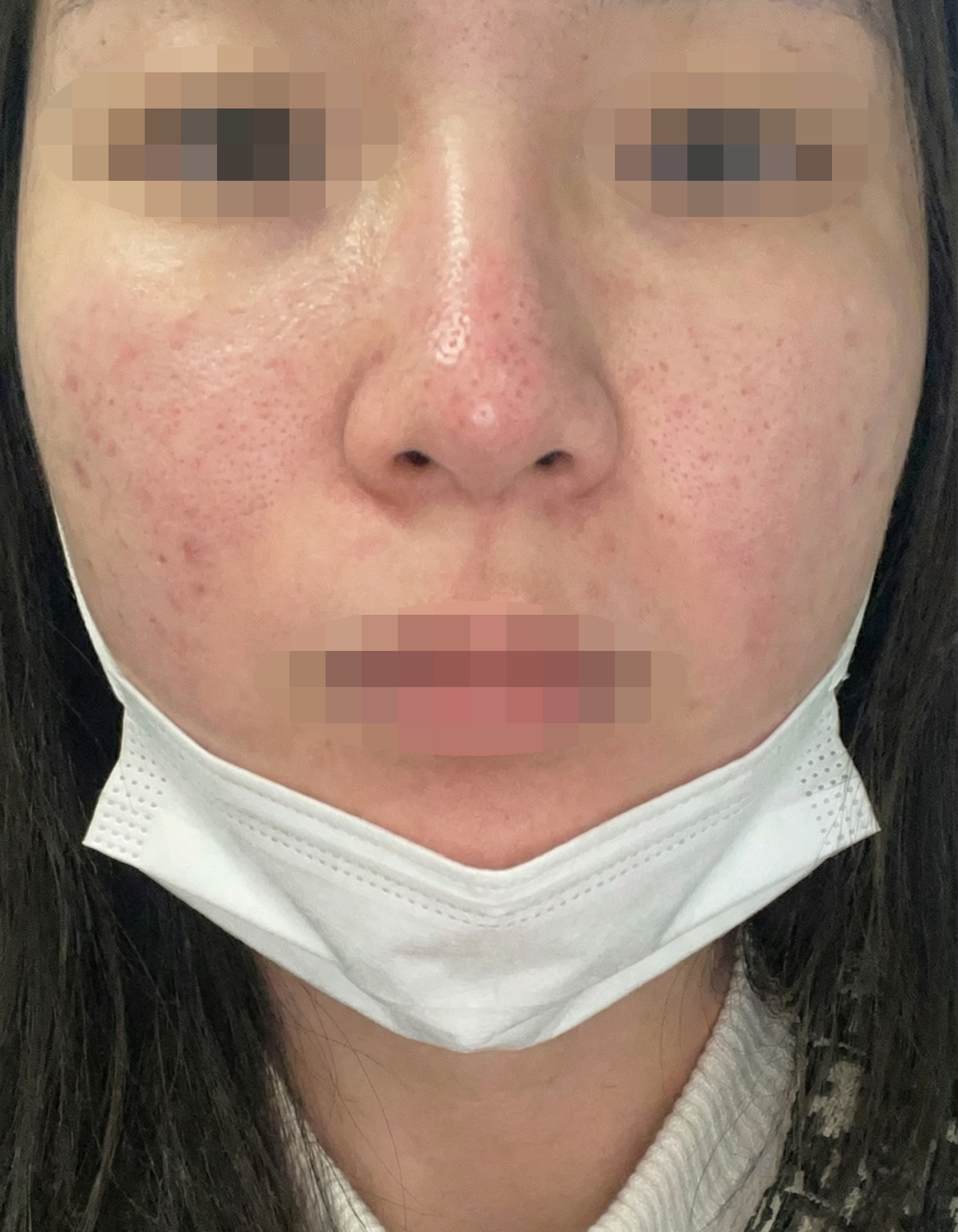 수술후기이미지