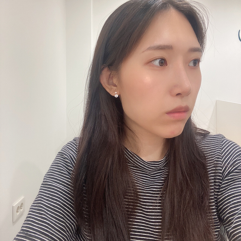 수술후기이미지