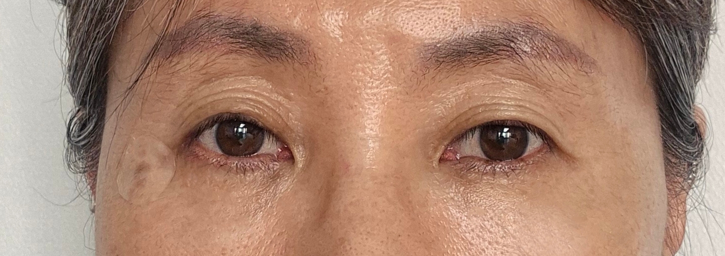 수술후기이미지