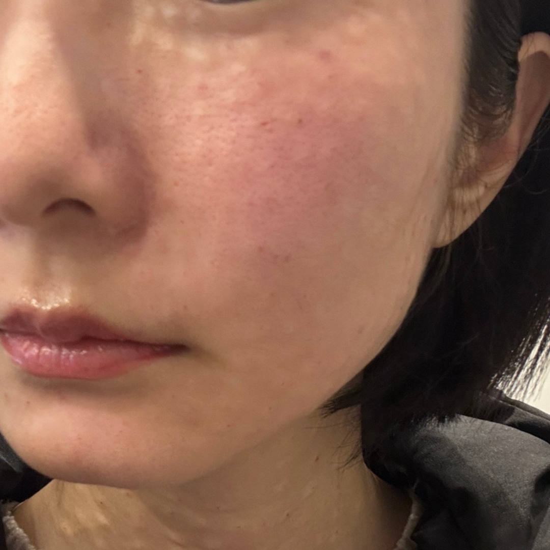 수술후기이미지