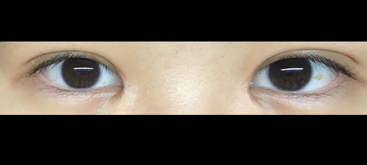 수술후기이미지