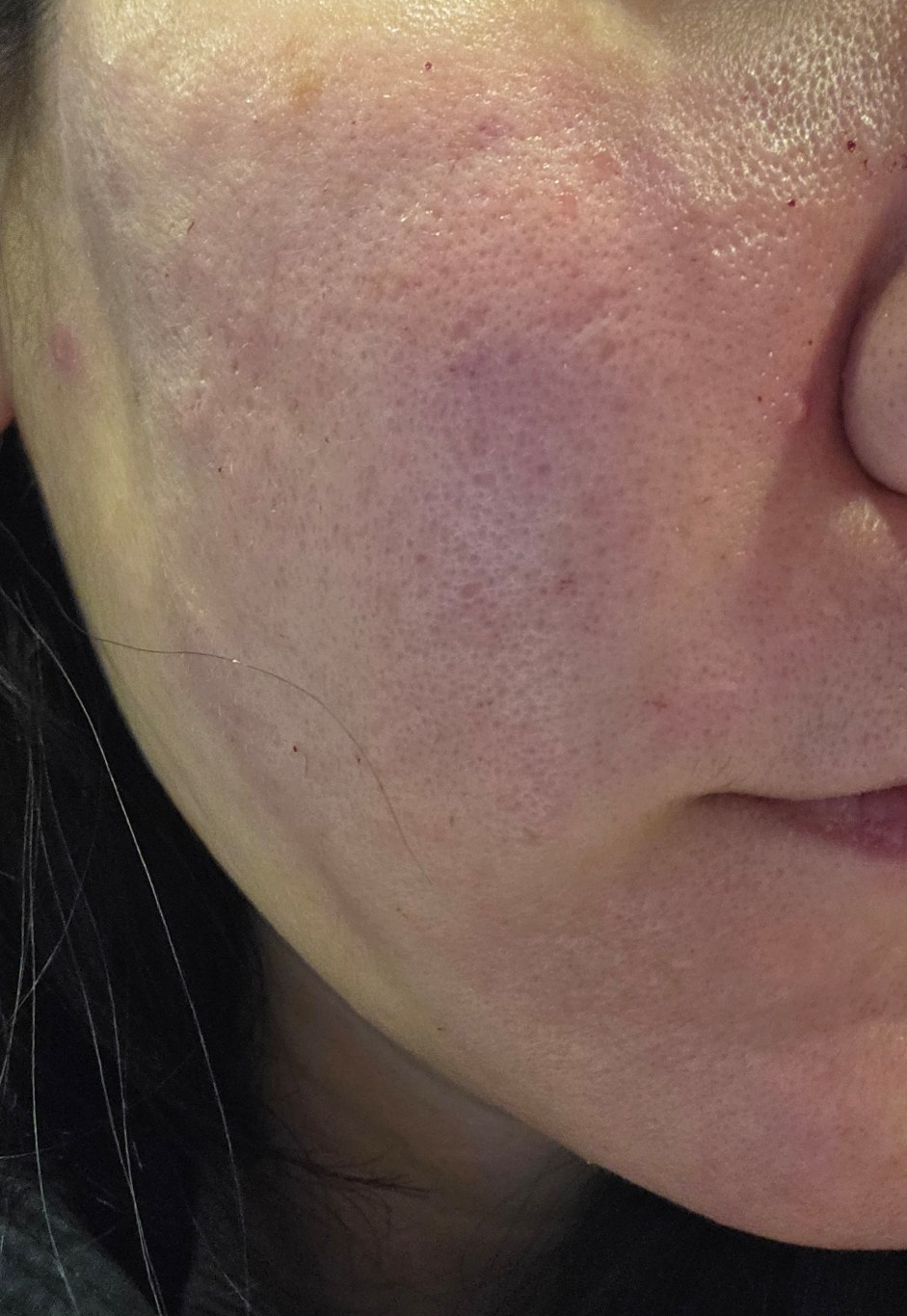 수술후기이미지