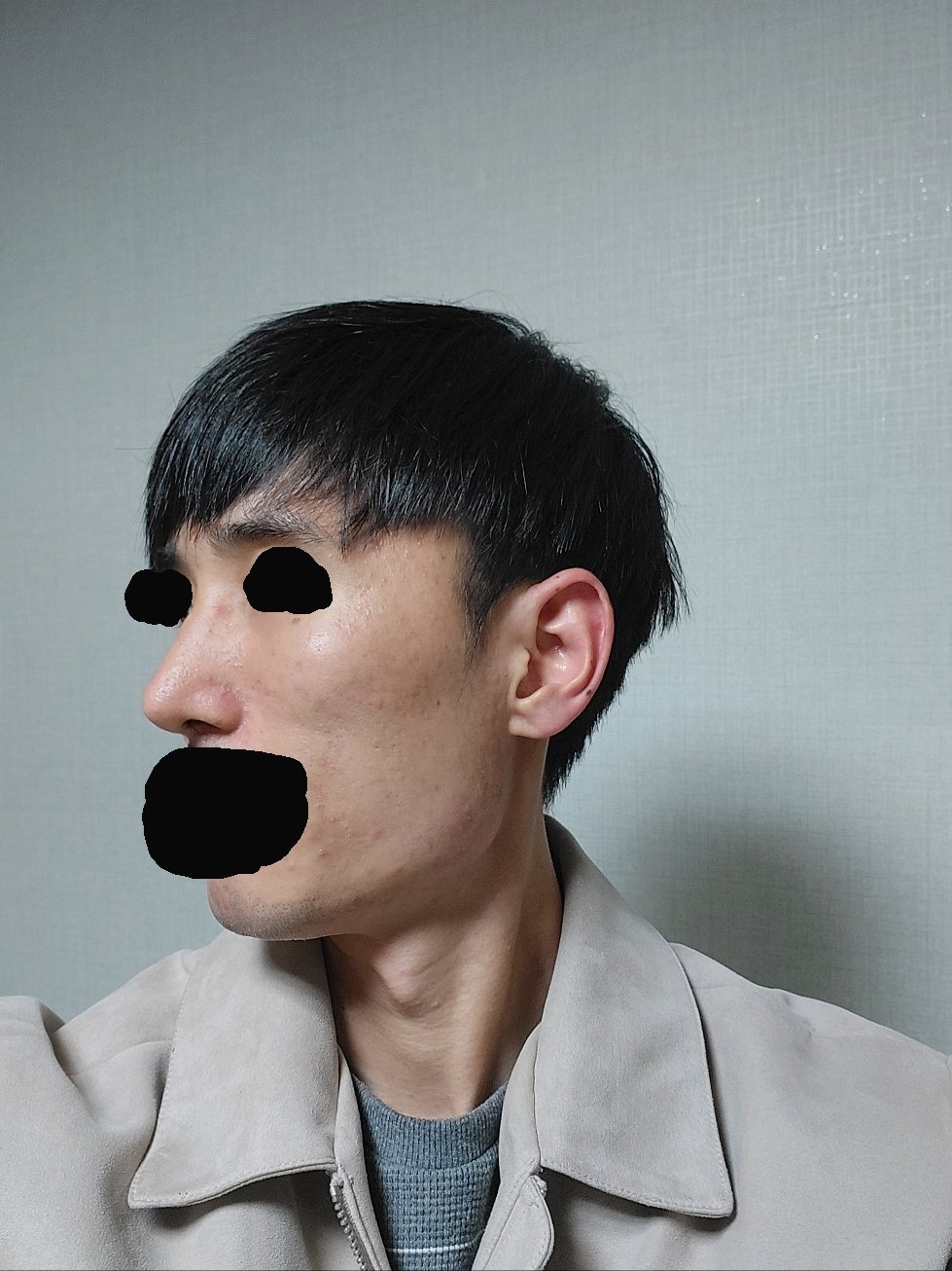 수술후기이미지