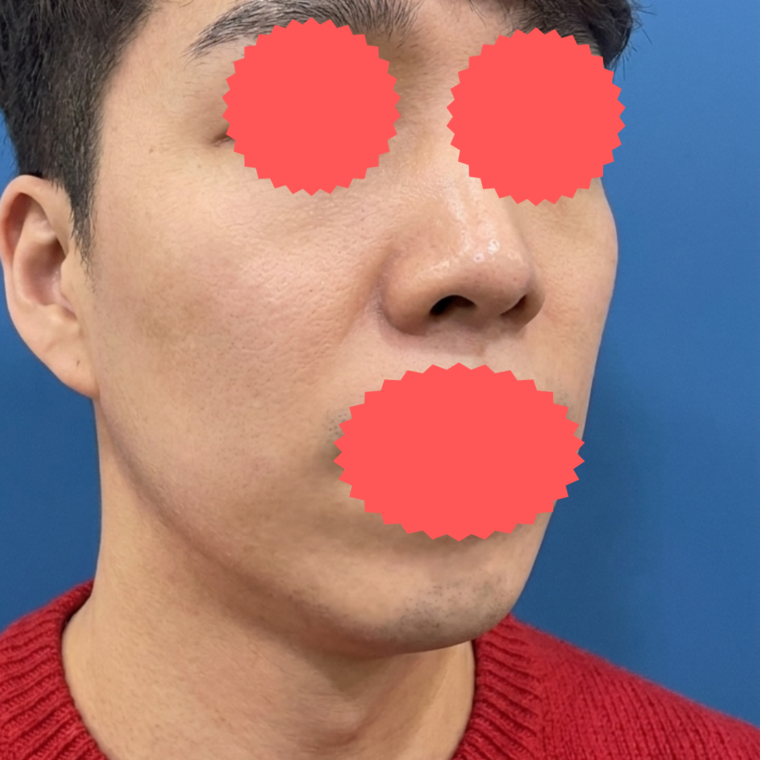 수술후기이미지