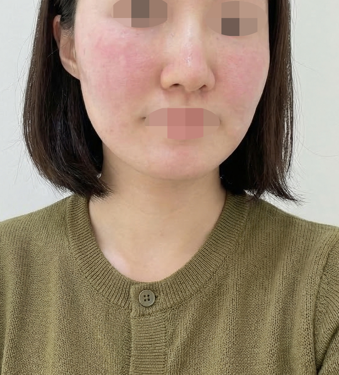 수술후기이미지