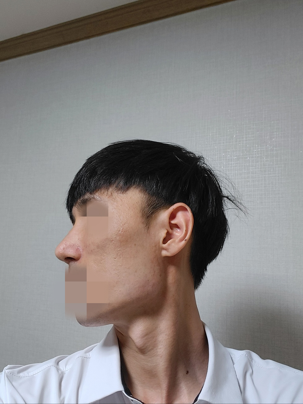 수술후기이미지